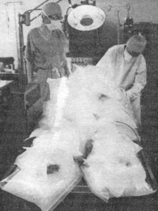 Jones’ body (above) was packed in ice soon after his death.
